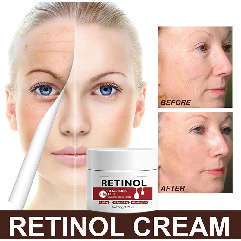 Retinol Firming Face Cream Lightens Wrinkles Prevents Aging Moisturizes And Firms Skin Anti Wrinkle Facial Skin Whitening Cream