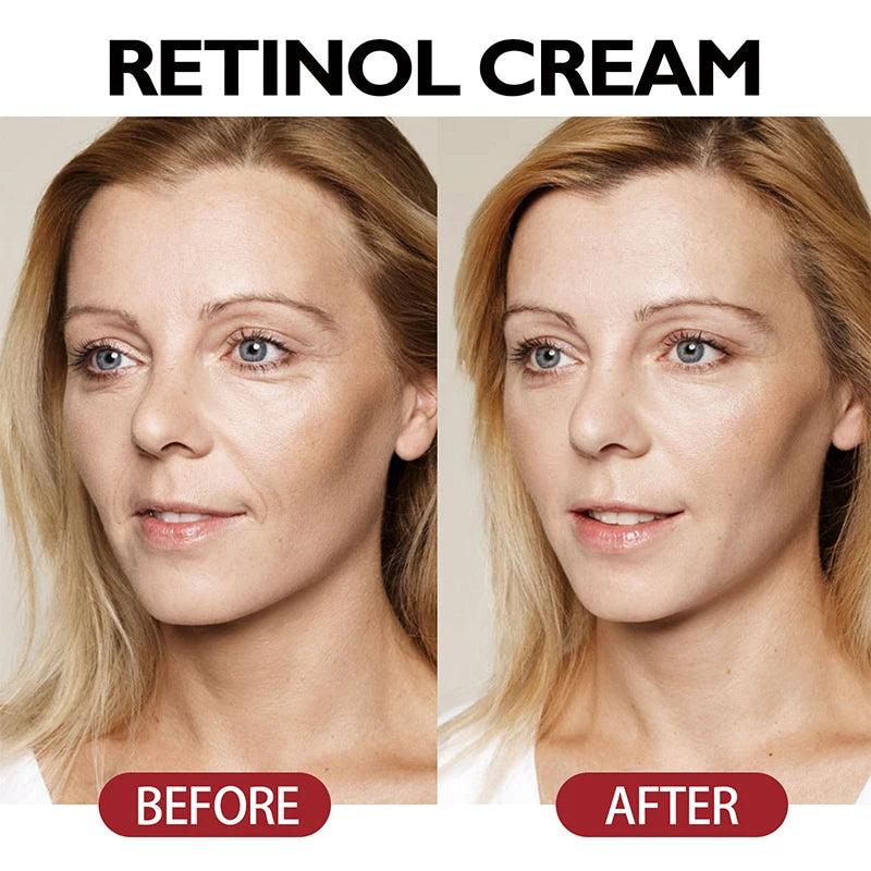 Retinol Firming Face Cream Lightens Wrinkles Prevents Aging Moisturizes And Firms Skin Anti Wrinkle Facial Skin Whitening Cream