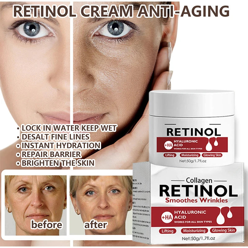 Retinol Firming Face Cream Lightens Wrinkles Prevents Aging Moisturizes And Firms Skin Anti Wrinkle Facial Skin Whitening Cream