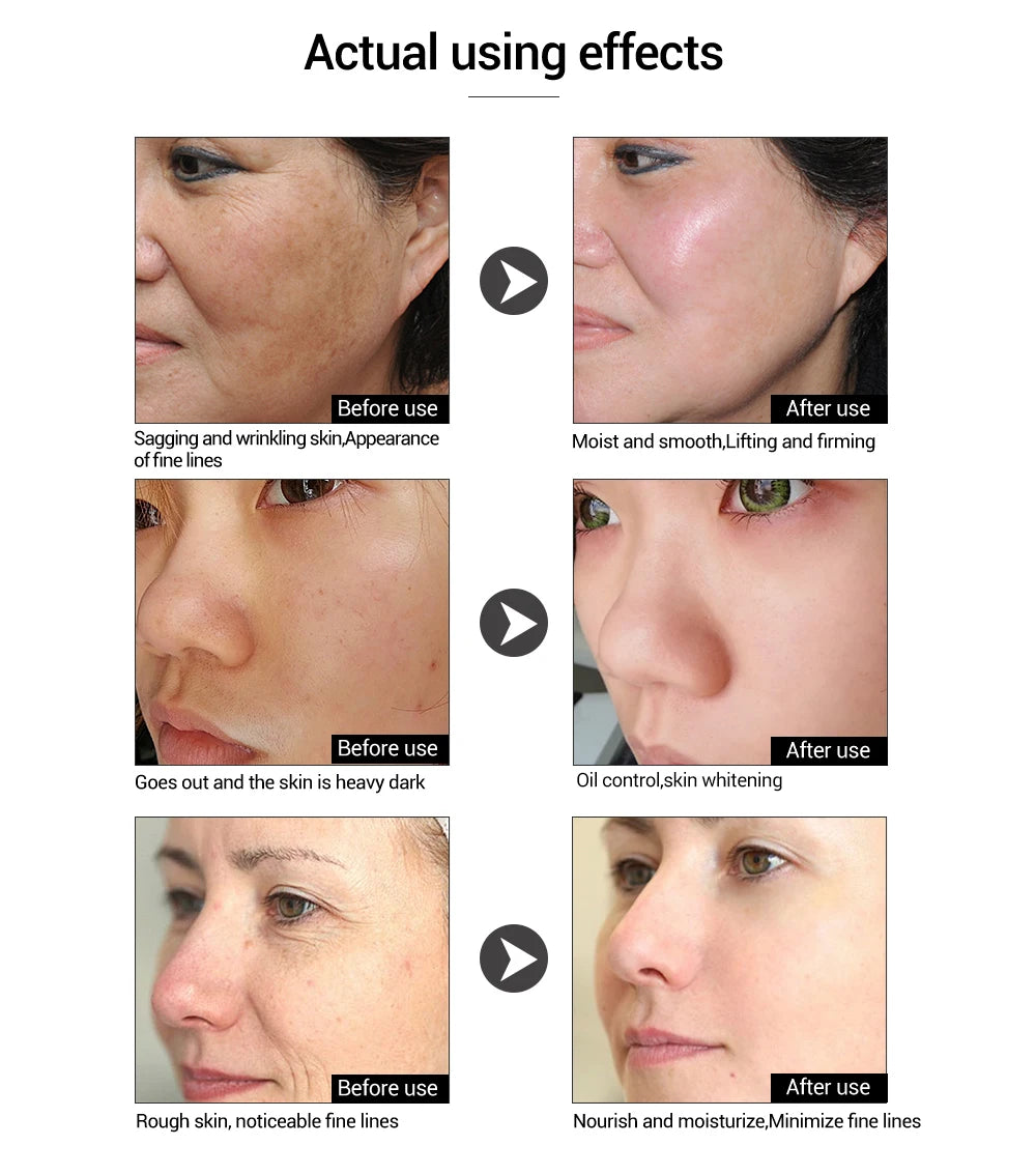 LANBENA 15ml Hyaluronic Acid Face Serum Deep Hydration Moisturizing Essence Skin Tightening Anti Aging Whitening Moisturizer