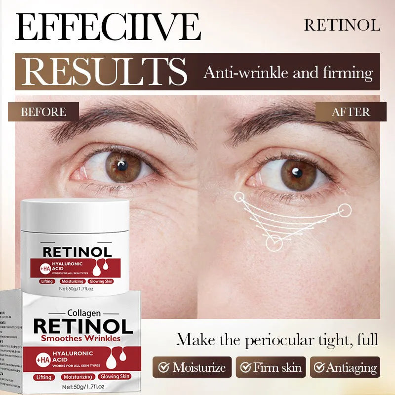 Retinol Firming Face Cream Lightens Wrinkles Prevents Aging Moisturizes And Firms Skin Anti Wrinkle Facial Skin Whitening Cream
