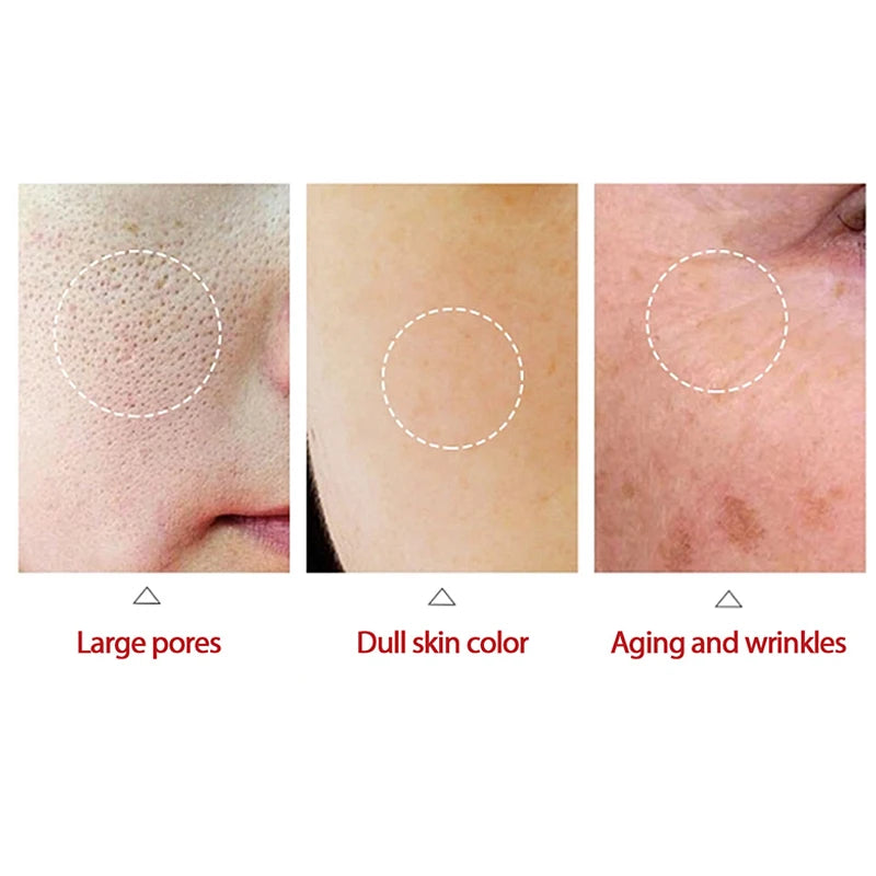 Retinol Firming Face Cream Lightens Wrinkles Prevents Aging Moisturizes And Firms Skin Anti Wrinkle Facial Skin Whitening Cream